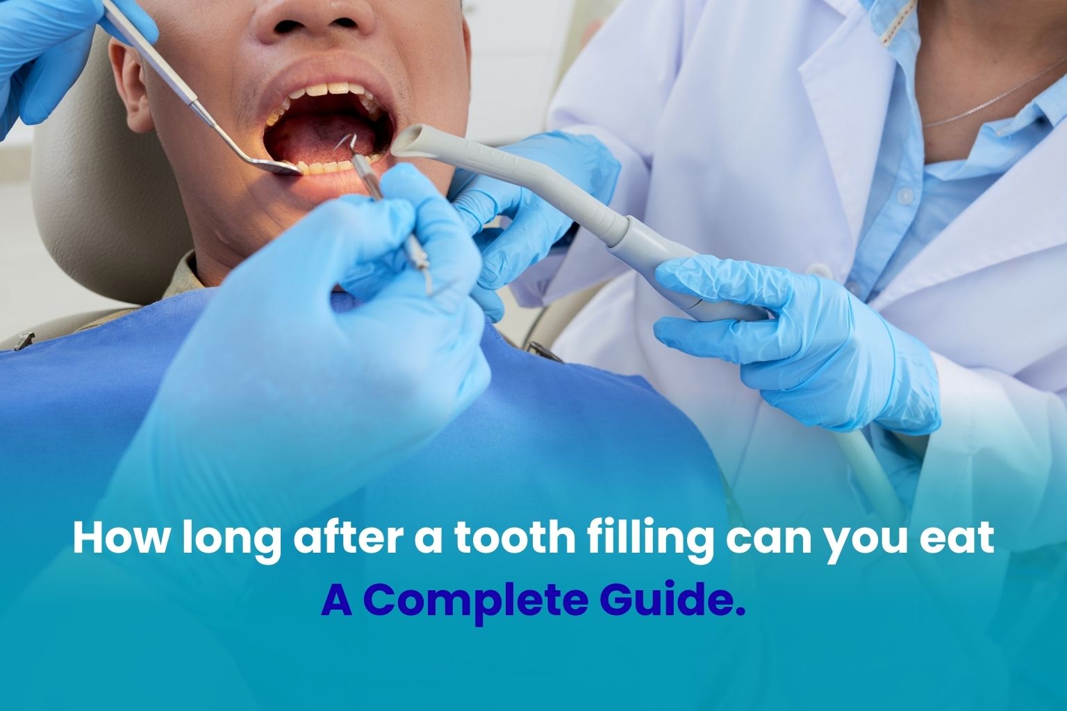 ow-long-after-a-tooth-filling-can-you-eat-A-Complete-Guide